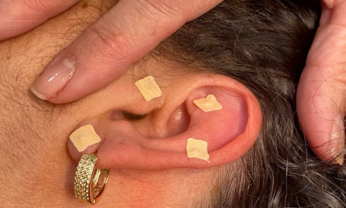 Vânia Magalhães Terapeuta Integrativa e Comportamental - Auriculoterapia