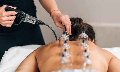 Ventosaterapia: o poder das ventosas no alívio de dores e na desintoxicação do corpo